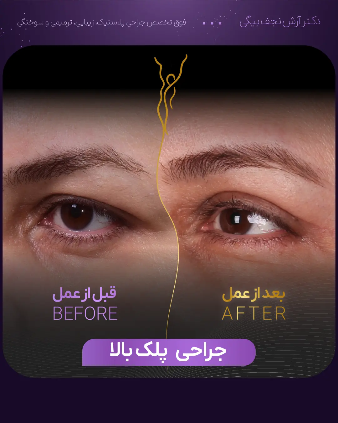 جوانسازی صورت